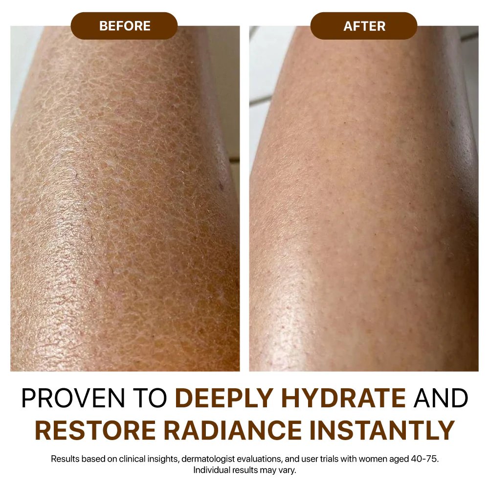 Before and after deeply hydrate