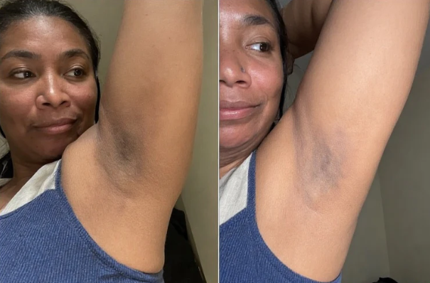 Underarm Brightening Cream